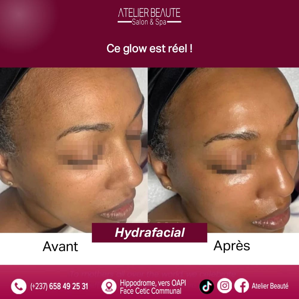 Soins du visage